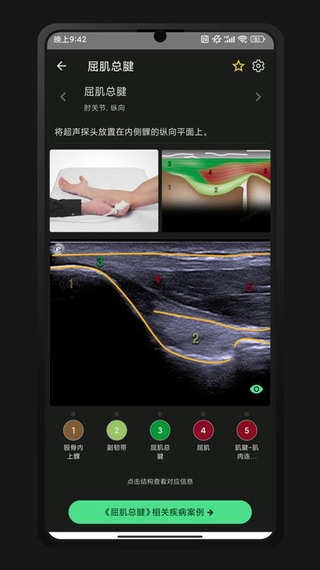 超聲智學(xué)截圖(4)